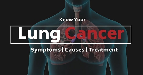 know-your-lung-cancer-symptoms-causes-treatment