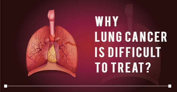 lung_cancer_treatment